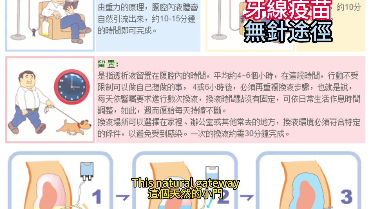 牙線疫苗 無針途徑