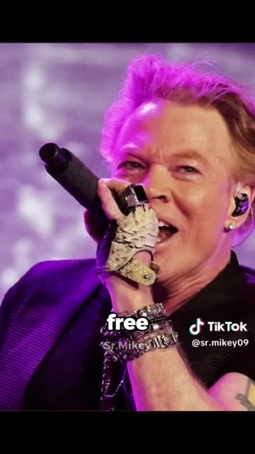 celebrities who ruined their faces with surgery - Axl Rose