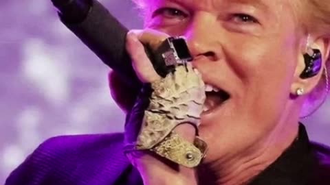 celebrities who ruined their faces with surgery - Axl Rose