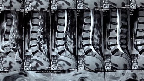 How Do X-Rays Actually Work.