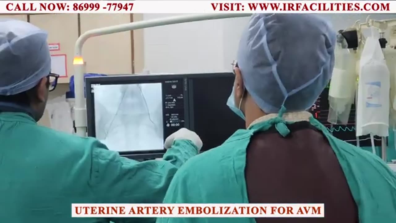 Uterine Artery Embolization for AVM | IRFACILITIES