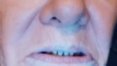 😂🤯 Chronic Pain Warrior Proves She's Not a Drug Addict! | FunFM