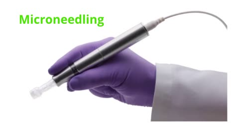 Laser Aesthetics LLC - Microneedling in Scottsdale, AZ