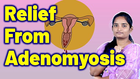 Best Treatment For Adenomyosis, Heavy Bleeding Uterus, Endometriosis Internal | Homeopathy, Medicine