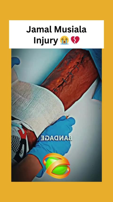 Jamal Musiala Injury 😭 💔