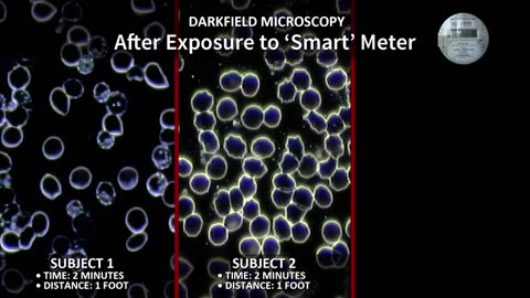 Documentary Feature: Take Back Your Power; the smart meter...