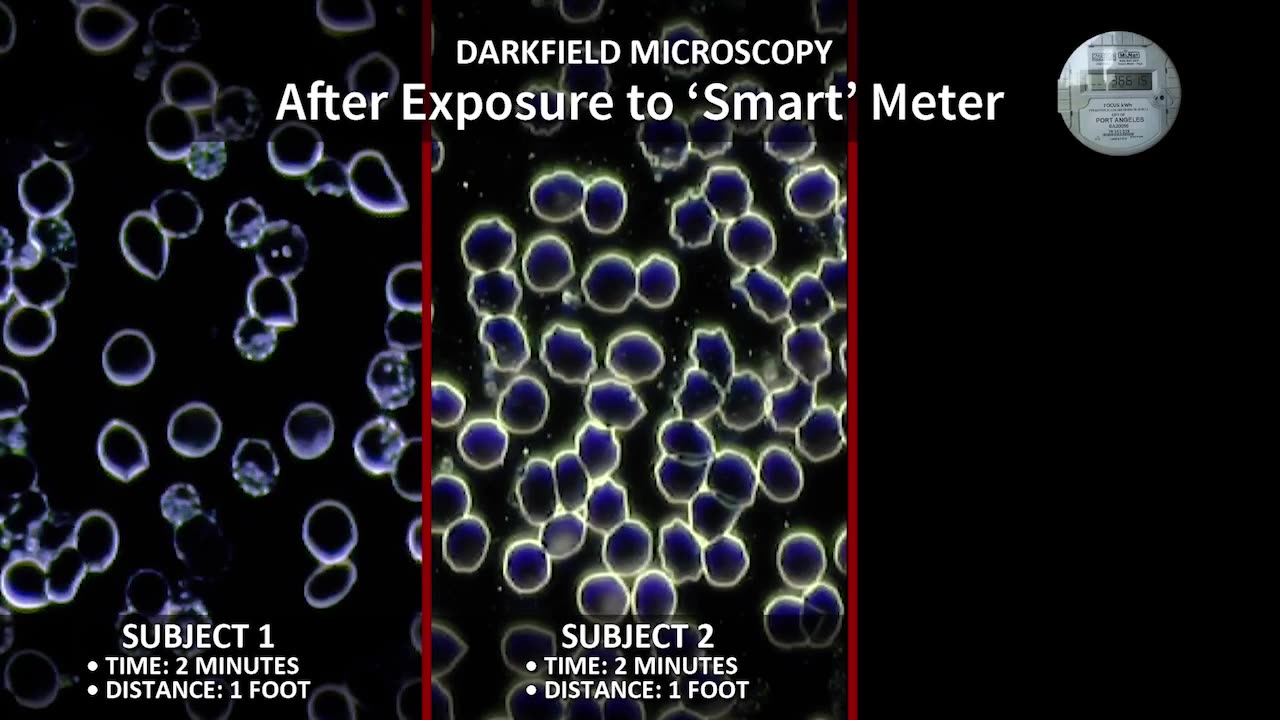 Documentary Feature: Take Back Your Power; the smart meter...