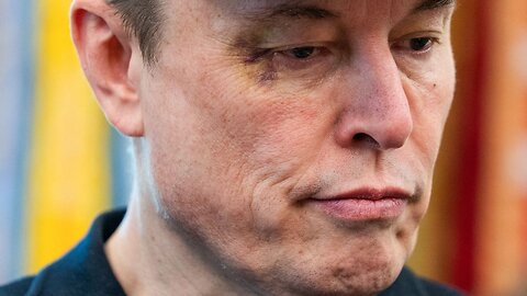 Elon Musk Spotted With Black Eye - Trump Stunned When Attacker Is Revealed