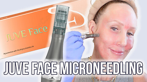 Juve Face Microneedling Face, Neck & Ears for Facial Rejuveantion