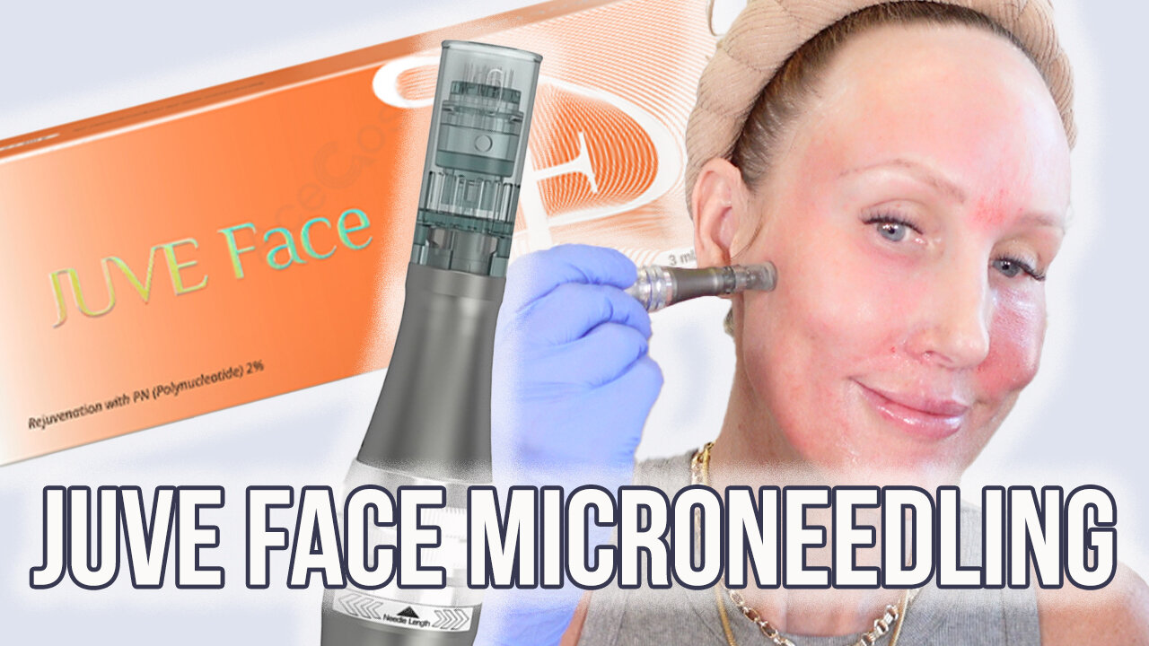 Juve Face Microneedling Face, Neck & Ears for Facial Rejuveantion