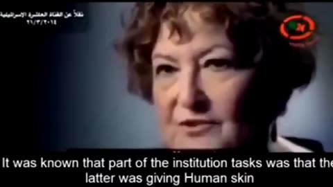 Israel has the largest human skin bank in the world but it holds nearly no Israeli skins..