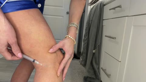 My Sclerotherapy Treatment for Spider Veins | Asklerol 3% Injection HEALTECH PHARMA