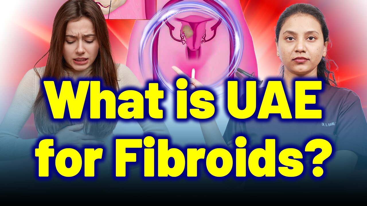 Uterine Artery Embolization (UAE) for Fibroids | Treatment & Cure | Homeopathy, Medicine & Surgery