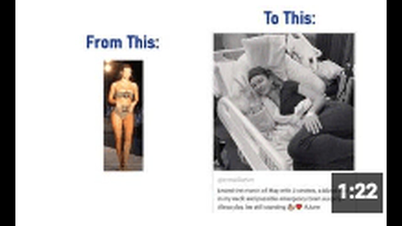 "Model Erin Willerton Survives Three Strokes, Blood Clot; Denies Vaccine as Cause"