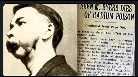 He followed his doctors instructions and his jaw fell off - Quacks and Quackzines just like now.💉