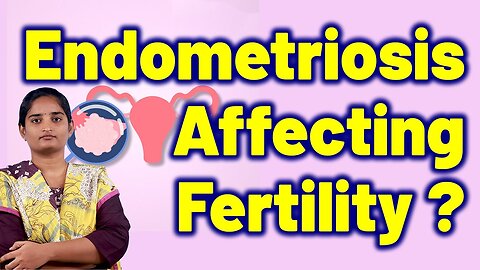 What are Endometriosis Causes & Signs, Fertility. | Homeopathy, Medicine Treatment and Cure