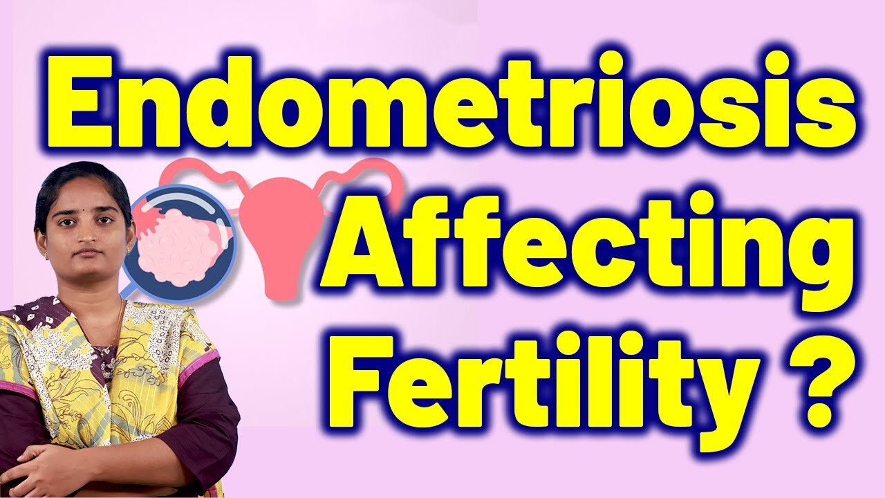 What are Endometriosis Causes & Signs, Fertility. | Homeopathy, Medicine Treatment and Cure