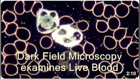"Unprecedented Explanation of 'Live Blood Analysis' & 'Dark Field Microscopy'"