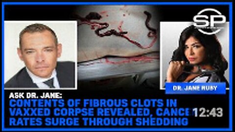 "Fibrous Clot Contents in Vaccinated Corpse Disclosed as Cancer Rates Spike due to Shedding"