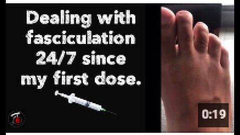 "Experiencing Constant Fasciculation After Initial Dose"