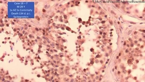 "Spike Protein Substitutes for Sperm"