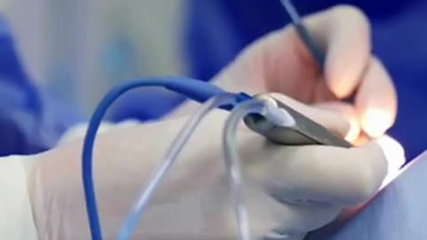 Neurosurgeon in Ludhiana | Dr Sukhdeep Singh Jhawar Neurosurgeon Brain Tumor Arora Neuro Centre