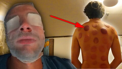 Korean Treatments Are NOT For The Weak 🇰🇷