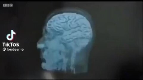 "Understanding the Impact of Junk Food on Your Brain's Neural Connections"