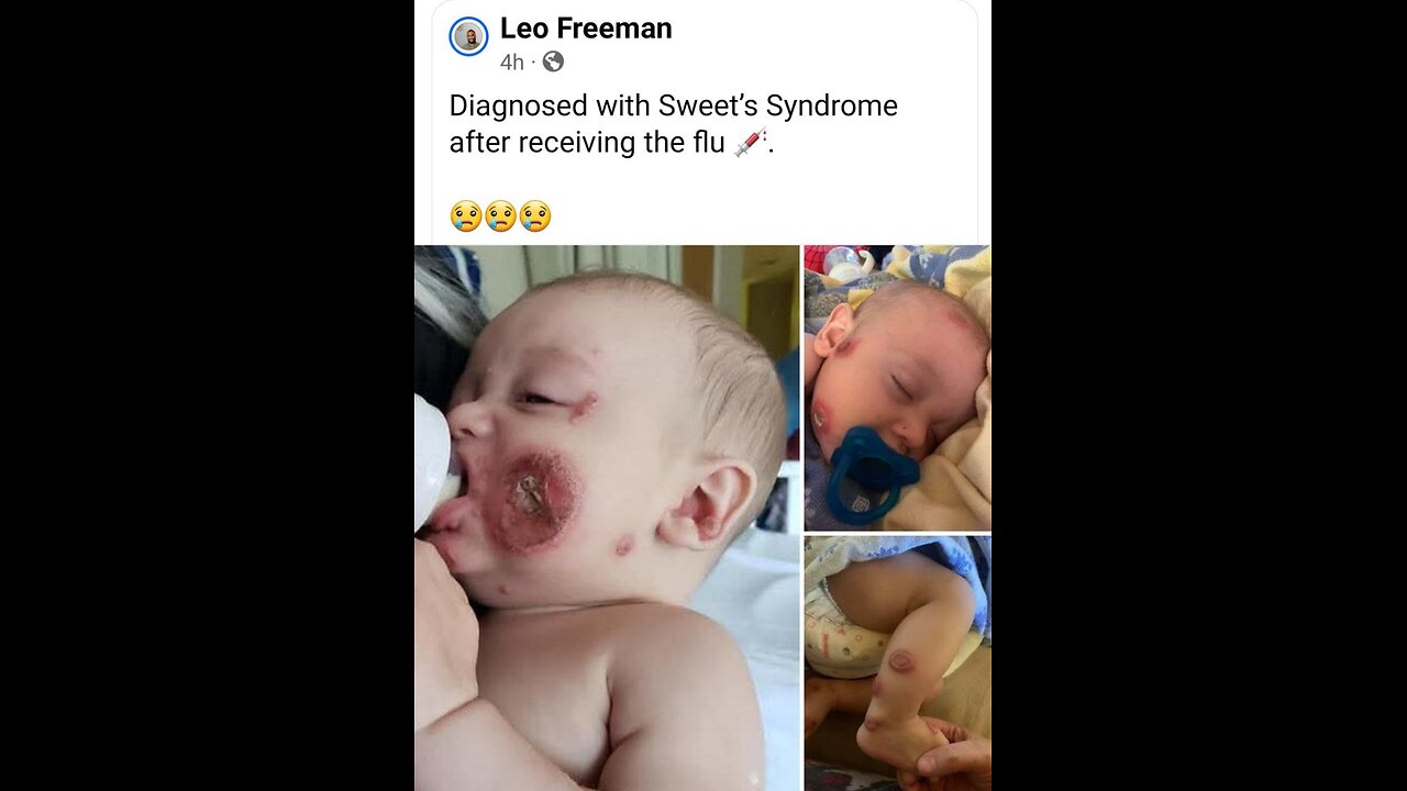 DONT FALL FOR IT , DONT GET NO V@X OR YOULL FALL FOR IT, TRUTH DOG TUNES