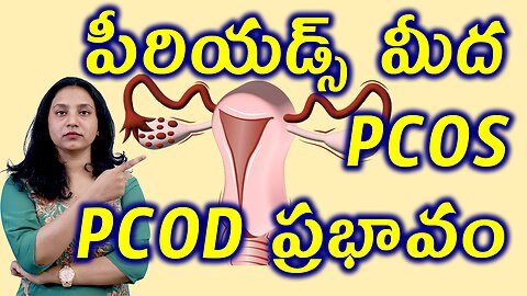పీరియడ్స్ మీద PCOS PCOD ప్రభావం PCOS and PCOD Effects on Menstrual cycle Homeopathy Treatment Cure