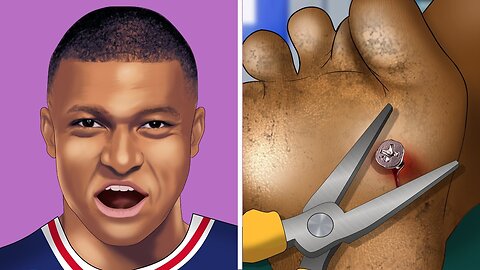 [ASMR] Remove rusty nails stuck into the legs | Toenail Care Animation