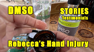 DMSO Stories: Rebecca's Hand
