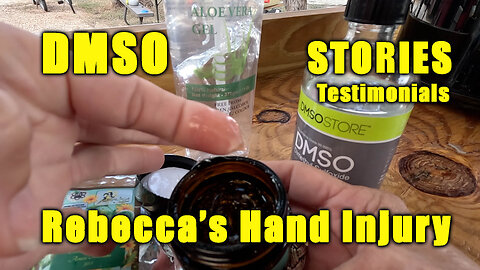 DMSO Stories: Rebecca's Hand