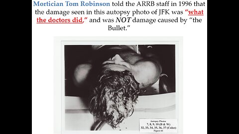 Mortician Tom Robinson's ARRB Testimony about JFK Craniotomy and Cause of Top of Head Wound