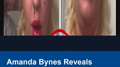Amanda Bynes Reveals She's Taking Ozempic for the Perfect Paparazzi Pic!