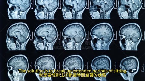 站起來救大腦 久坐增失智風險
