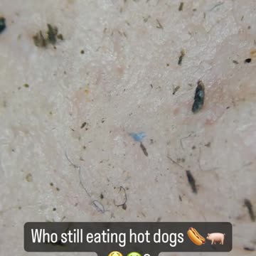 What’s Really in a Hot Dog — And Why They’re Dangerous to Your Health.