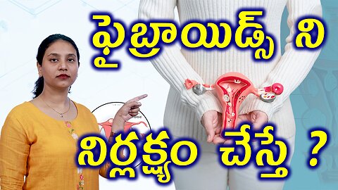 ఫైబ్రాయిడ్స్ ని నిర్లక్ష్యం చేస్తే?Neglect Problems of FibroidsRemovalSurgery RadioFrequencyAblation