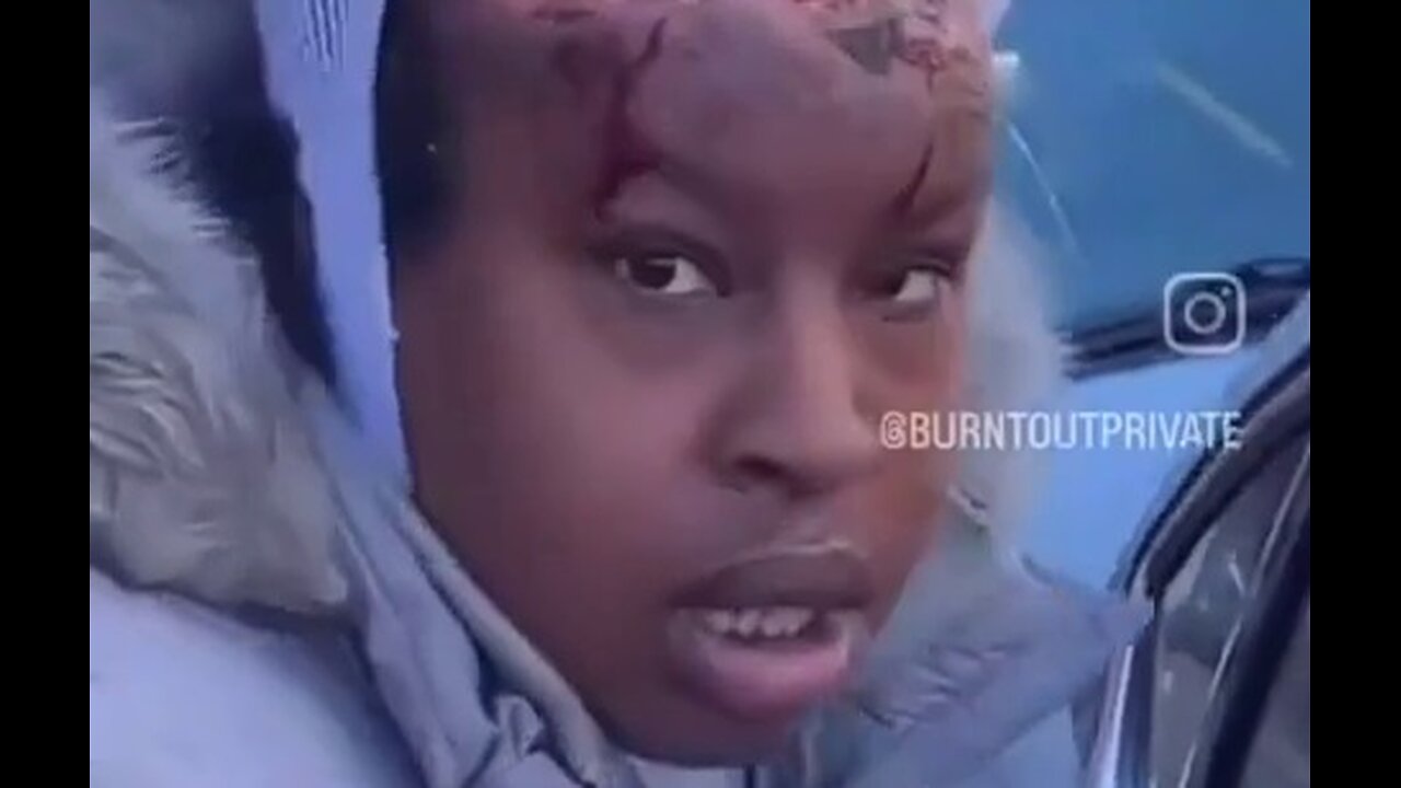 Is this the Start of the Zombie Apocalypse? VIEWER DISCRETION ADVISED