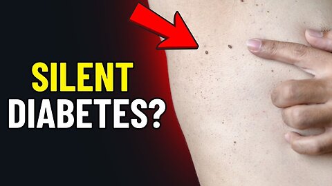 SKIN TAGS: Discover What's Actually Causing Them |JN65
