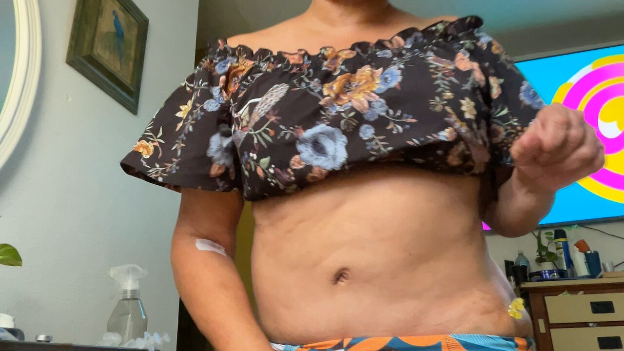 DIY threads on tummy tuck scars!