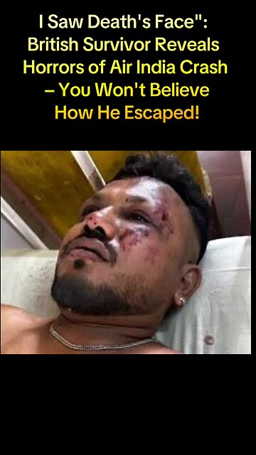 I Saw Death's Face": British Survivor Reveals Horrors of Air India Crash – You Won't Believe it