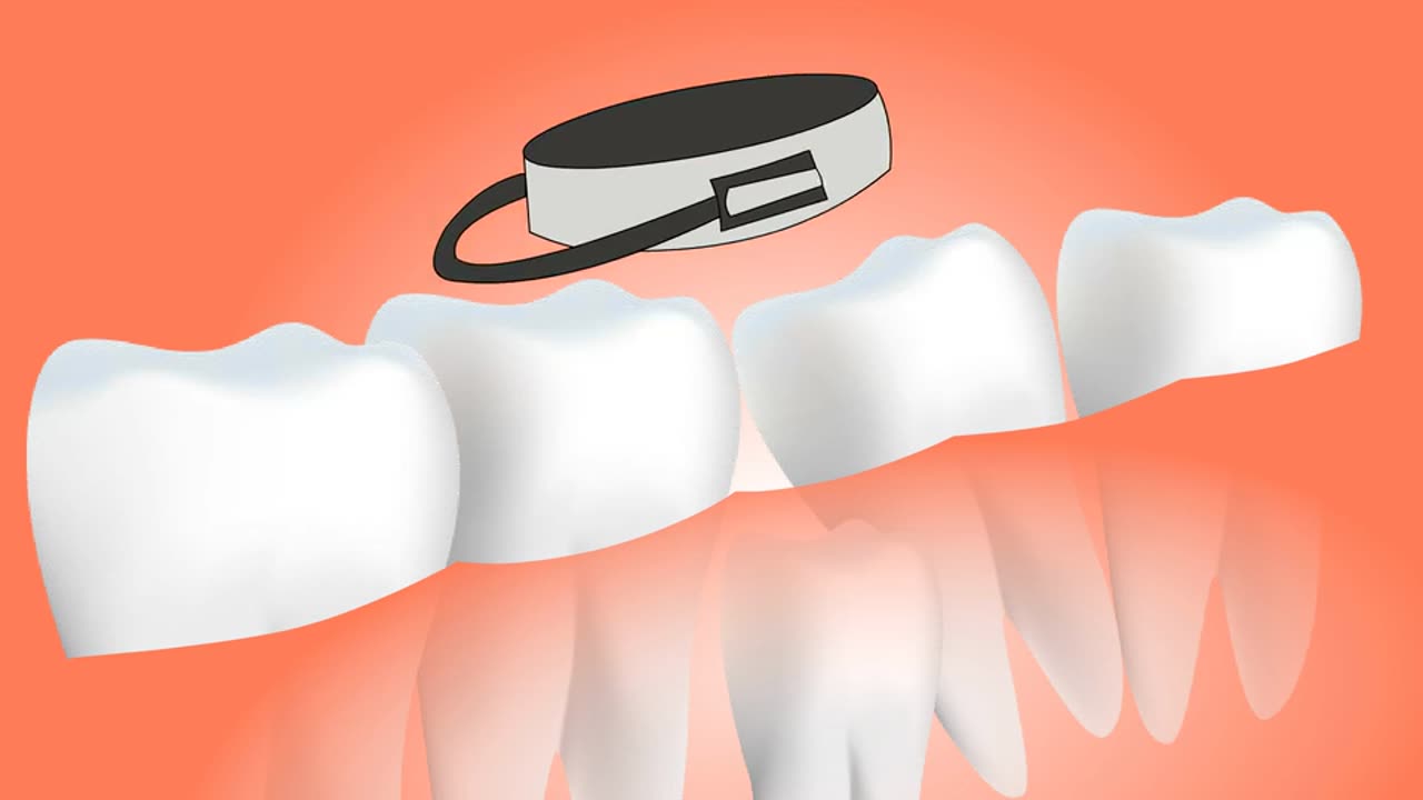 Dental, surgery, tooth