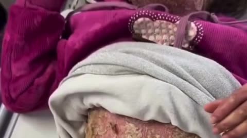 Gaza doctors report unidentified viruses and bacteria causing unknown illnesses spreading...