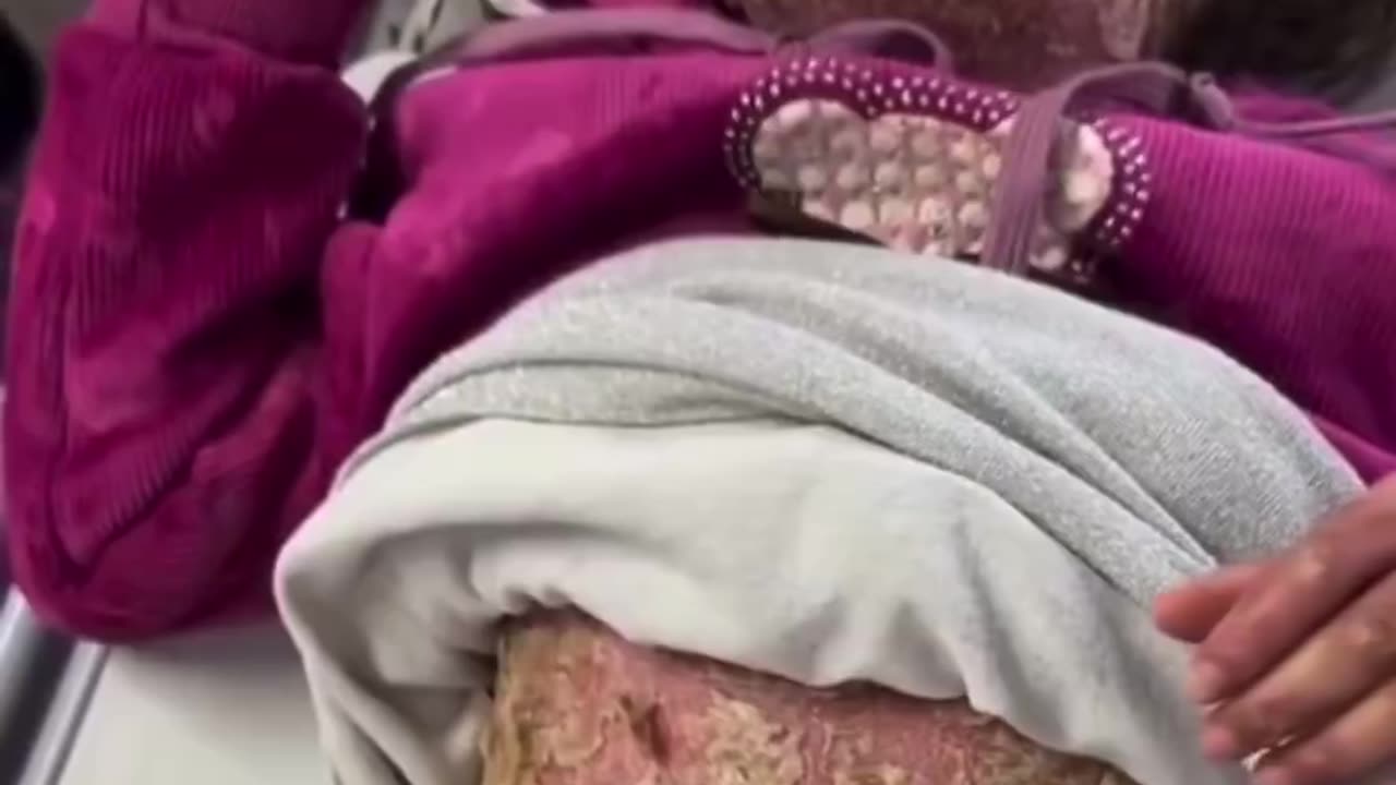 Gaza doctors report unidentified viruses and bacteria causing unknown illnesses spreading...