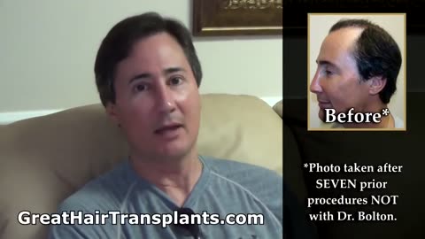 Great Hair Transplants: Dr. Brett Bolton Corrects Failed Hair Transplants