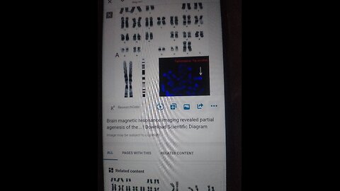 Secrets of the y chromosome unknown genes