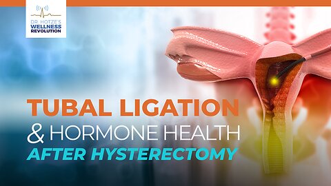 Tubal Ligation & Hormone Health After Hysterectomy