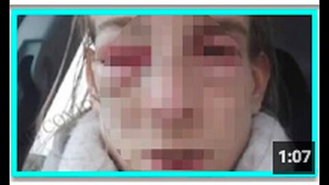 "Close Call: Woman's Life in Peril Post-Vaccination Booster Shot"