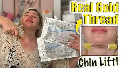 Real Gold Thread Chin Lift at Home! AceCosm.com and code Jessica10 Saves you Money
